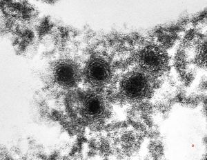 M,67y. | herpetic encephalitis (parafin embedded sample)